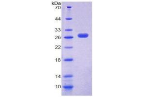SDS-PAGE (SDS) image for Chemokine (C-X-C Motif) Ligand 16 (CXCL16) (AA 31-241) protein (His tag) (ABIN2124316)