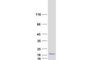 Validation with Western Blot (COMMD6 Protein (Transcript Variant 2) (Myc-DYKDDDDK Tag))