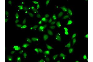 Immunofluorescence analysis of HeLa cells using C1S antibody (ABIN6290127). (C1S antibody)