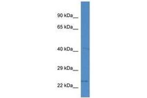 Image no. 1 for anti-Solute Carrier Family 10 (Sodium/bile Acid Cotransporter Family), Member 2 (SLC10A2) (AA 50-99) antibody (ABIN6746226) (SLC10A2 antibody  (AA 50-99))