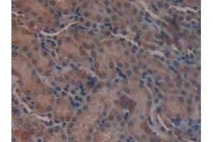 Immunohistochemistry (IHC) image for anti-Glutamate Dehydrogenase 1 (GLUD1) (AA 65-273) antibody (ABIN7431527)