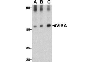 Western blot analysis of VISA in rat brain tissue lysate with this product at (A) 0. (MAVS antibody  (Middle Region))