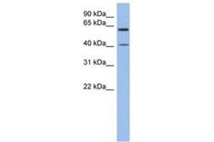 Image no. 1 for anti-beta 1,3-Galactosyltransferase-Like (B3GALTL) (C-Term) antibody (ABIN6743519) (B3GALTL antibody  (C-Term))