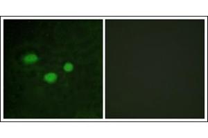 Immunofluorescence analysis of HeLa cells, using DNMT3B Antibody.