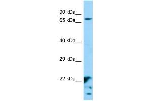 Western Blotting (WB) image for anti-XK, Kell Blood Group Complex Subunit-Related Family, Member 6 (XKR6) (Middle Region) antibody (ABIN2790600) (XKR6 antibody  (Middle Region))