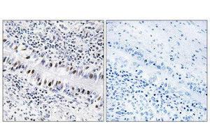 Immunohistochemistry (IHC) image for anti-Zinc Finger Protein 76 (Expressed in Testis) (ZNF76) (Internal Region) antibody (ABIN1849340) (ZNF76 antibody  (Internal Region))