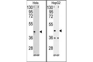 Western blot analysis of anti-hPGK1 pab pre-incubated with and without blocking peptide in Hela (LEFT) and HepG2 (RIGHT) cell line lysate. (PGK1 antibody  (Middle Region))