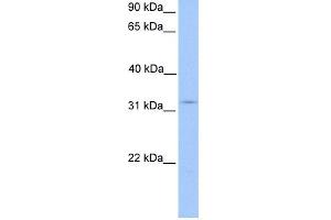 WB Suggested Anti-KCTD21 Antibody Titration: 0. (KCTD21 antibody  (N-Term))
