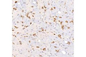 Immunohistochemistry analysis of paraffin-embedded rat brain using,KCNG3 (ABIN7075157) at dilution of 1: 2000 (KCNG3 antibody)