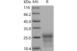 Western Blotting (WB) image for CD90 (THY1) protein (His tag) (ABIN7320272) (CD90 Protein (THY1) (His tag))