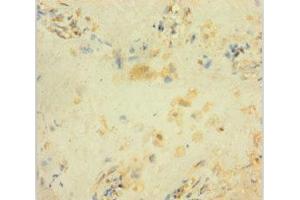Immunohistochemistry of paraffin-embedded human placenta tissue using ABIN7154468 at dilution of 1:100 (GADD45B antibody  (AA 1-160))