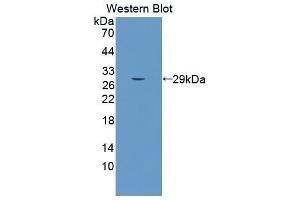 Western Blotting (WB) image for anti-Sema Domain, Seven Thrombospondin Repeats (Type 1 and Type 1-Like), Transmembrane Domain (TM) and Short Cytoplasmic Domain, (Semaphorin) 5B (SEMA5B) (AA 350-602) antibody (ABIN5662014) (SEMA5B antibody  (AA 350-602))