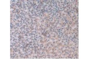 Detection of a1AGP in Rat Adrenal Gland Tissue using Monoclonal Antibody to Alpha-1-Acid Glycoprotein (a1AGP) (ORM1 antibody  (AA 19-186))