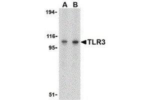 Western Blotting (WB) image for anti-Toll-Like Receptor 3 (TLR3) (C-Term) antibody (ABIN2479740) (TLR3 antibody  (C-Term))