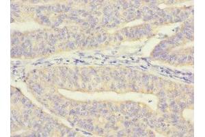 MRPL12 antibody  (AA 1-198)