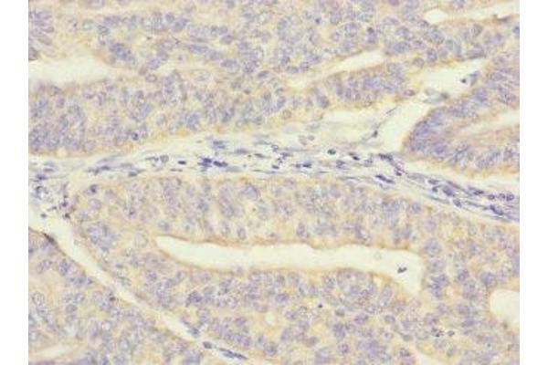 MRPL12 antibody  (AA 1-198)