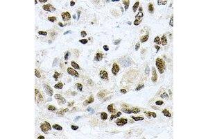 Immunohistochemical analysis of UBE2B staining in rat lung formalin fixed paraffin embedded tissue section. (UBE2B antibody)