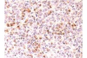 Immunohistochemistry (IHC) image for anti-Cyclin-Dependent Kinase Inhibitor 2C (p18, Inhibits CDK4) (CDKN2C) antibody (ABIN487307) (CDKN2C antibody)