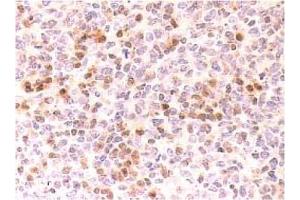 Immunohistochemistry (IHC) image for anti-Cyclin-Dependent Kinase Inhibitor 2C (p18, Inhibits CDK4) (CDKN2C) antibody (ABIN487307)