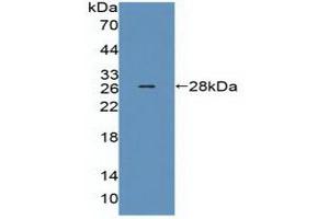 Detection of Recombinant MED1, Human using Polyclonal Antibody to Mediator Complex Subunit 1 (MED1) (MED1 antibody  (AA 1-212))