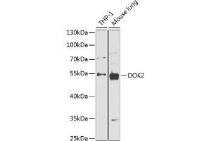 Western blot analysis of extracts of various cell lines, using DOK2 antibody (ABIN6130308, ABIN6139765, ABIN6139767 and ABIN6218320) at 1:1000 dilution.