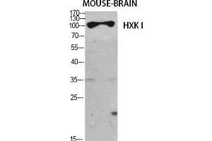 Western Blot analysis of various cells using HXK I Polyclonal Antibody diluted at 1:1000. (HXK I (AA 1-80) antibody)