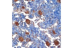 Immunohistochemistry of paraffin-embedded mouse bone marrow using CXCL4/CXCL4/PF4 Rabbit mAb (ABIN1683188, ABIN3017983, ABIN3017984 and ABIN7101555) at dilution of 1:100 (40x lens). (PF4 antibody)