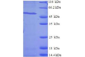 SDS-PAGE (SDS) image for Ral GEF with PH Domain and SH3 Binding Motif 1 (RALGPS1) (AA 1-305) protein (His-SUMO Tag) (ABIN5711369)