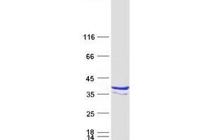 Validation with Western Blot (RFPL3 Protein (Transcript Variant 2) (Myc-DYKDDDDK Tag))