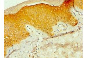 Immunohistochemistry of paraffin-embedded human skin tissue using ABIN7146856 at dilution of 1:100 (CSNK1A1L antibody  (Isoform alpha))