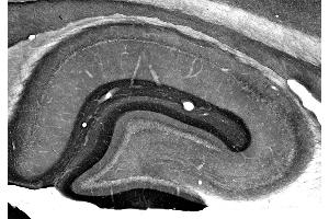Adult rat hippocampus immunohistochemistry.