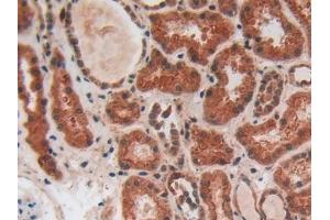 Immunohistochemistry (IHC) image for anti-Placental Alkaline Phosphatase (ALPP) (AA 162-312) antibody (ABIN7432097)