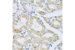 Immunohistochemistry of paraffin-embedded human stomach using ATPIF1 antibody.