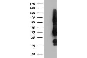 HEK293T cells were transfected with the pCMV6-ENTRY control (Left lane) or pCMV6-ENTRY GRAP2 (Right lane) cDNA for 48 hrs and lysed. (GRAP2 antibody)