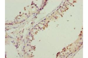Immunohistochemistry of paraffin-embedded human testis tissue using ABIN7142411 at dilution of 1:100 (MRPL41 antibody  (AA 14-137))