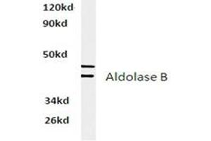 Image no. 2 for anti-Aldolase B, Fructose-Bisphosphate (ALDOB) antibody (ABIN317837) (ALDOB antibody)