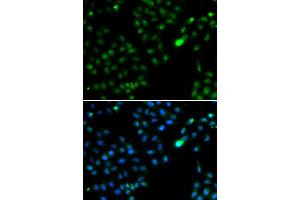 Immunofluorescence analysis of HeLa cell using FKBP3 antibody. (FKBP3 antibody)