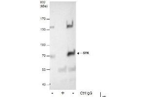IP Image Immunoprecipitation of SYK protein from A431 whole cell extracts using 5 μg of SYK antibody [N2C2], Western blot analysis was performed using SYK antibody [N2C2], EasyBlot anti-Rabbit IgG  was used as a secondary reagent. (SYK antibody  (Internal Region))