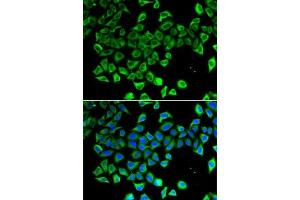 Immunofluorescence analysis of A-549 cells using Lipocalin-2/NGAL antibody (ABIN6128177, ABIN6143114, ABIN6143115 and ABIN6215076). (Lipocalin 2 antibody)