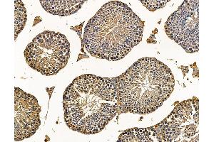 ABIN7095739 and ABIN7099801 at 1/100 staining mouse testis tissue by IHC-P. (MGAT5 antibody)