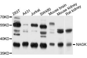 Western blot analysis of extract of various cells, using NAGK antibody. (NAGK antibody)