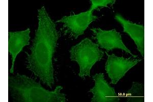 Immunofluorescence (IF) image for anti-Tropomodulin 3 (TMOD3) (AA 280-352) antibody (ABIN526110)