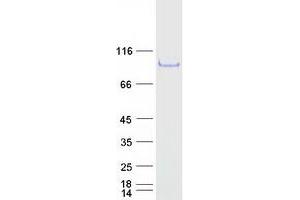 G Patch Domain Containing 3 (GPATCH3) protein (Myc-DYKDDDDK Tag)