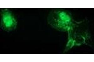 Anti-CTNNB1 mouse monoclonal antibody (ABIN2454136) immunofluorescent staining of COS7 cells transiently transfected by pCMV6-ENTRY CTNNB1 (RC208947). (CTNNB1 antibody)