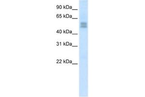 Western Blotting (WB) image for anti-LIM Homeobox Transcription Factor 1, beta (LMX1B) antibody (ABIN2461655) (LMX1B antibody)