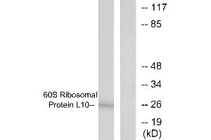Western blot analysis of extracts from K562 cells, treated with Insulin (0. (RPL10 antibody  (Internal Region))
