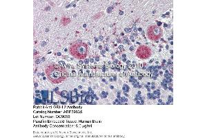 Immunohistochemistry (IHC) image for anti-Grainyhead-Like 2 (GRHL2) (Middle Region) antibody (ABIN2778358) (GRHL2 antibody  (Middle Region))