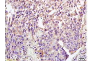 Immunohistochemistry (Paraffin-embedded Sections) (IHC (p)) image for anti-Sodium Potassium ATPase, alpha1 (ATP1A1) (pTyr10) antibody (ABIN683173)