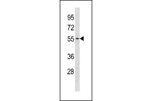 GTDC1 Antibody (Center) (ABIN1881395 and ABIN2843292) western blot analysis in Jurkat cell line lysates (35 μg/lane). (GTDC1 antibody  (AA 278-304))