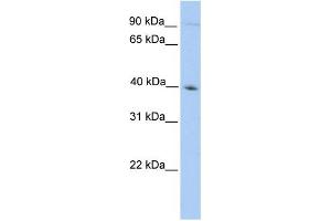 WB Suggested Anti-ODF2 Antibody Titration: 0. (ODF2 antibody  (N-Term))